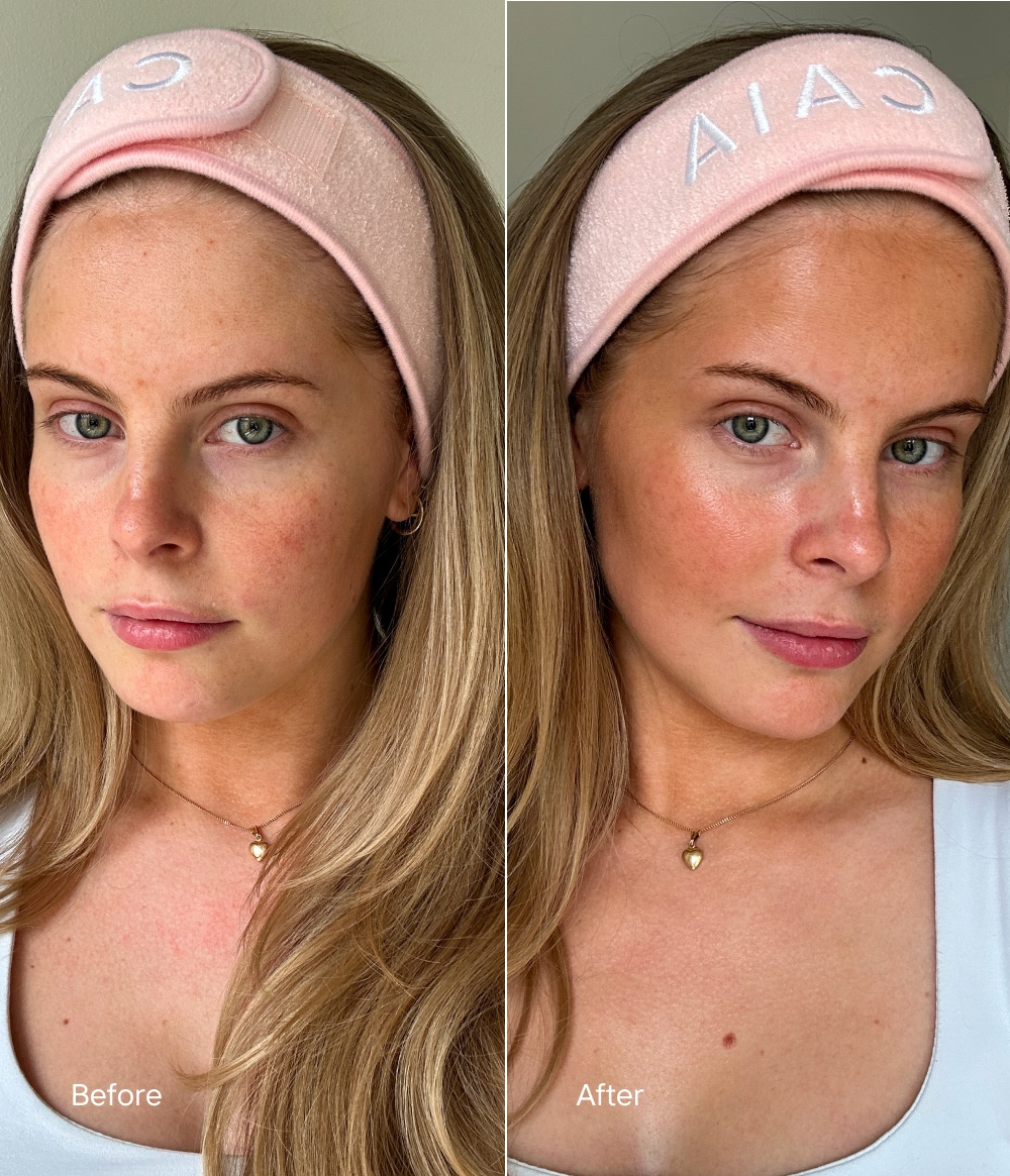 RADIANCE TAN SELF TAN MIST RADIANCE TAN SELF TAN MIST